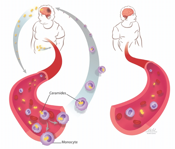 Diagram: ceramides in a person with high vs. moderate body mass