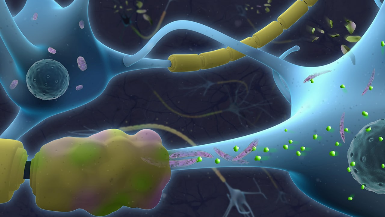 illustration of neurons wrapped with normal vs.damaged myelin