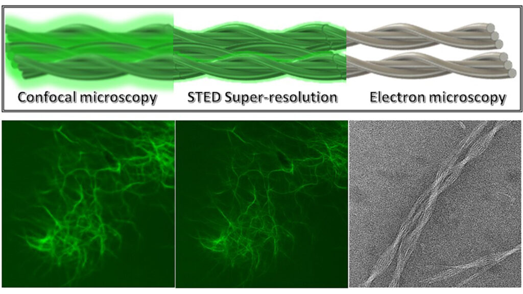 3 examples of nanoscale microscopy