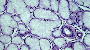 Light micrograph of human sublingual salivary gland