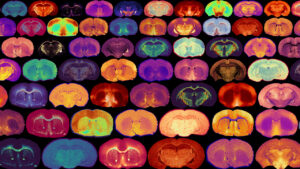A vibrant grid of brain slices, each displaying distinct colors and patterns, illustrating various neural structures and highlights.