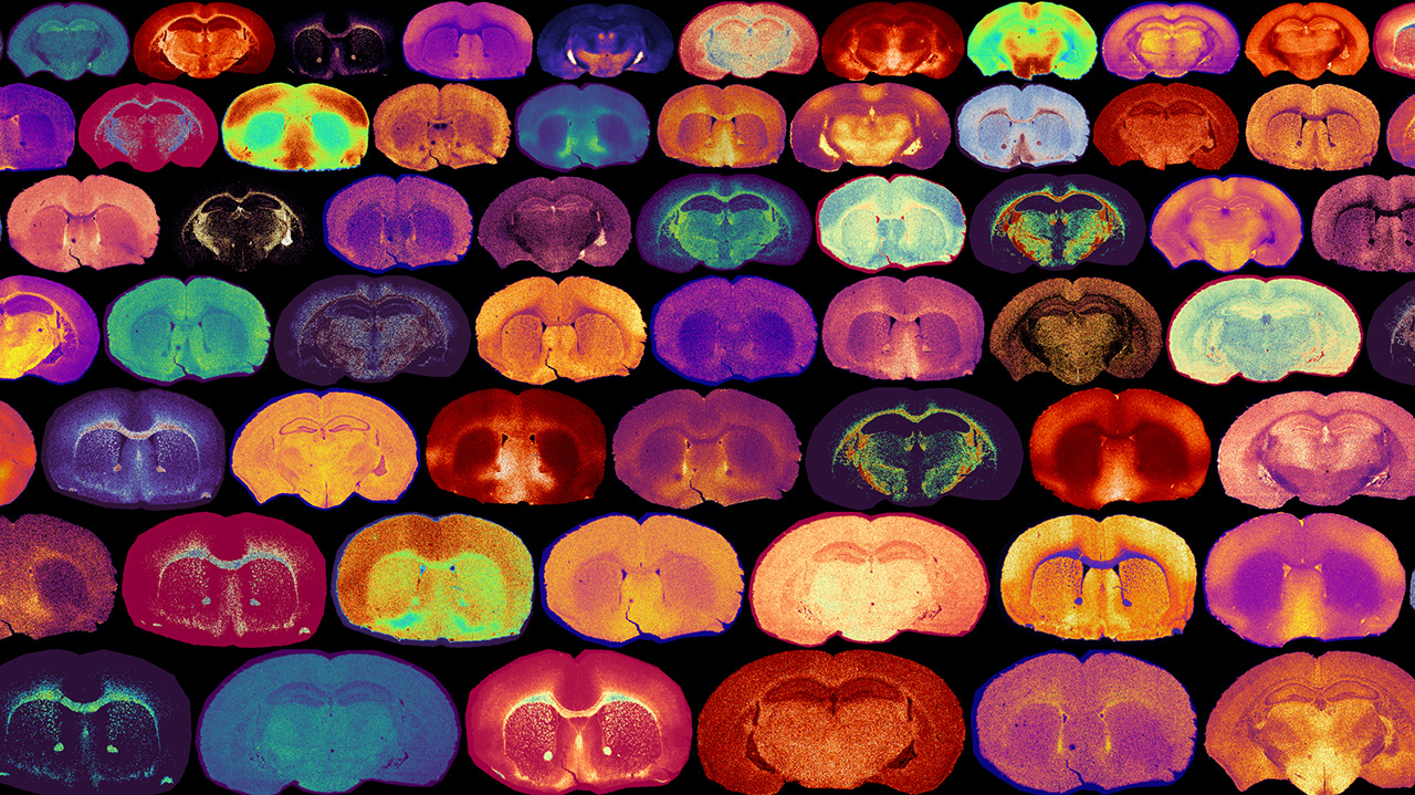 A grid of vibrant, colored microscopic images of brain tissue sections, showcasing various patterns and textures.